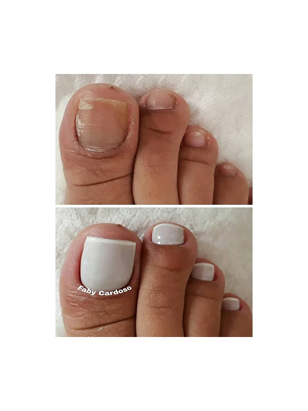 Antes e depois 1