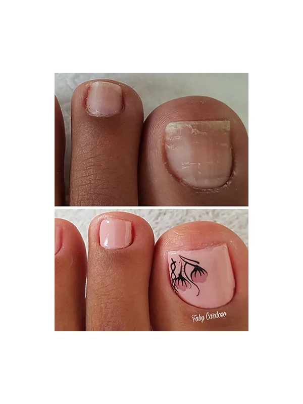Antes e depois 2