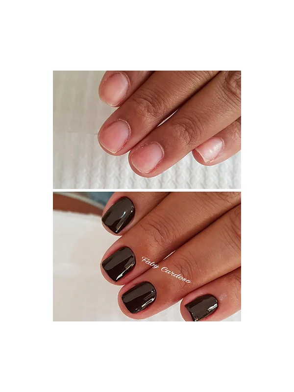 Antes e depois 3