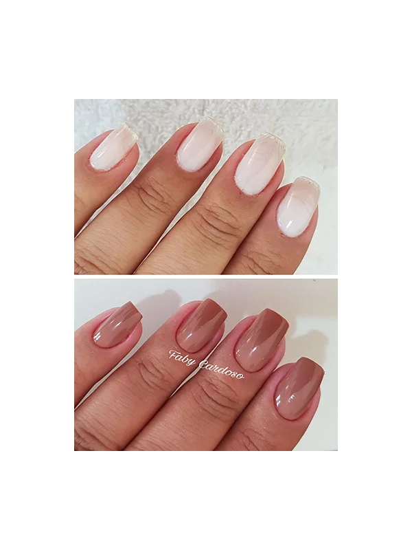 Antes e depois 4